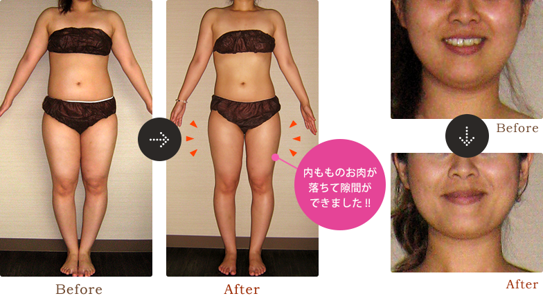 内もものお肉が落ちて隙間ができました !!