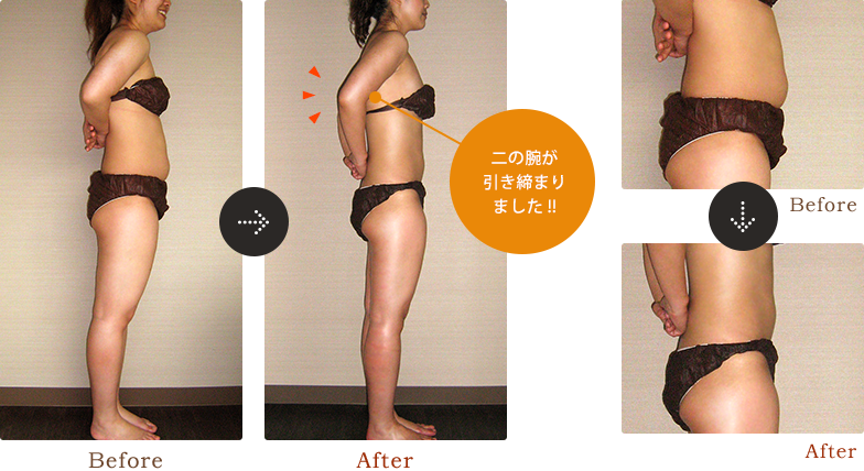 二の腕が引き締まりました !!